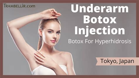 Underarm Botox Injection Botox For Hyperhidrosis Trambellir
