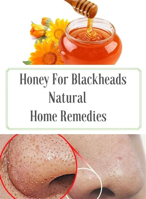 How To Remove Blackheads Home Remedies With Honey