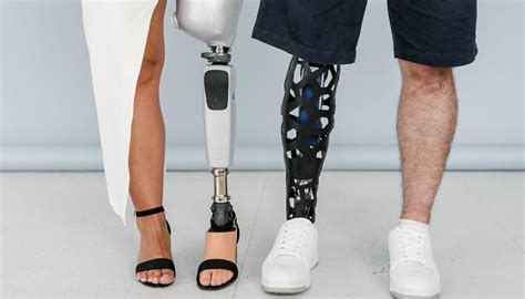 Types Of Prosthetics