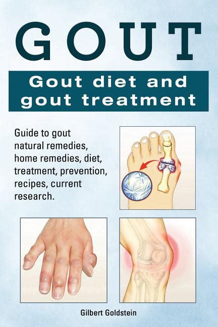 Gout Gout Diet And Gout Treatment Guide To Gout Natural Remedies