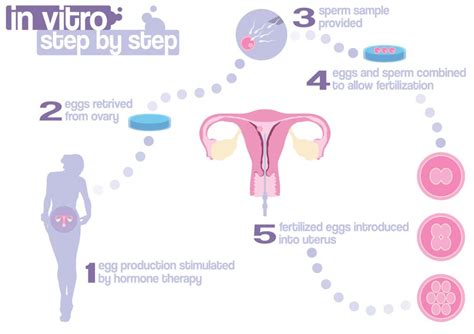 In Vitro Fertilization Definition And Stages Of How It Works My Xxx Hot Girl