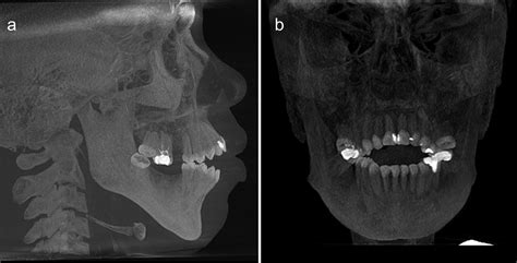 Cone Beam Computed Tomographic Imaging In Orthodontics Scarfe 2017