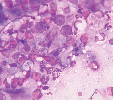 Feline Eosinophilic Granuloma Complexities Some Clinical