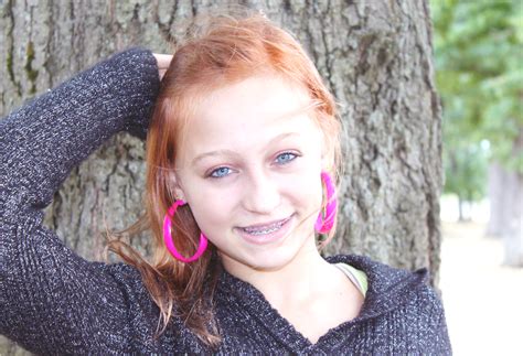 Teenage Girl Braces Coquitlam Orthodontics Clinic Evergreen Orthodontics