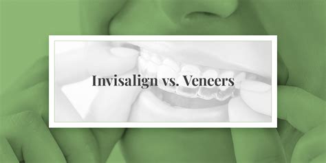 Invisalign Vs Veneers Everything You Need To Know