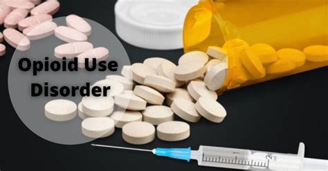 Opioid Use Disorder Signs Causes Treatment And More
