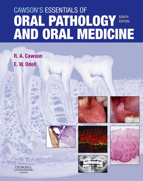 Cawsons Essentials Of Oral Pathology And Oral Medicine 8th