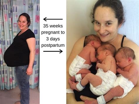 Stages Of Pregnancy With Triplets
