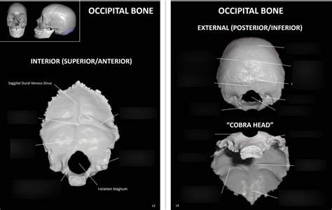 Spinal Lab Practical Ii Occipital Bone Diagram Quizlet