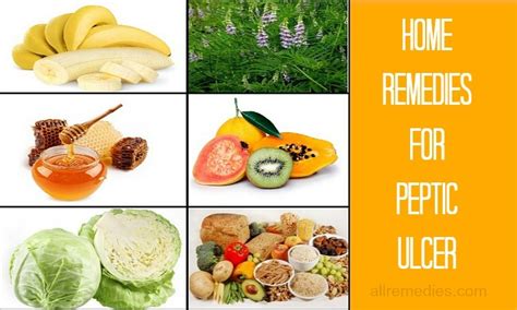 24 Home Remedies For Peptic Ulcer Pain