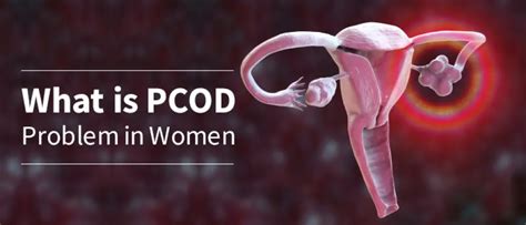 What Is Pcod Problem In Women