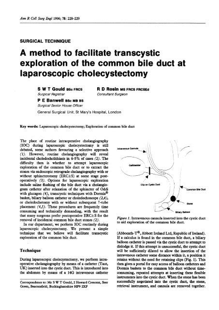 A Method To Facilitate Transcystic Exploration Of The Common Bile Duct