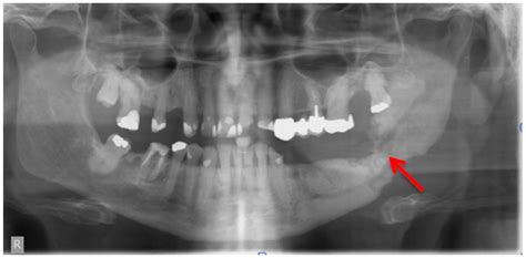 Dentistry Journal Free Full Text Imaging In Patients With
