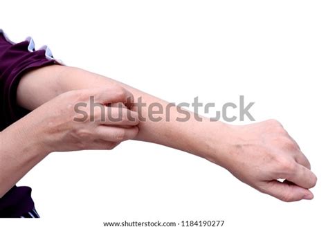 Women Scratch Itch Hand On White Stock Photo Edit Now 1184190277