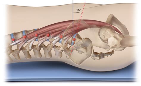 Psoas Major Function Spinal Joint Actions Sagittal Plane
