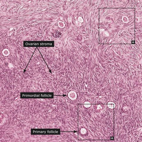 Dictionary Normal Ovary Histología Anatomia Patologica Anatomía