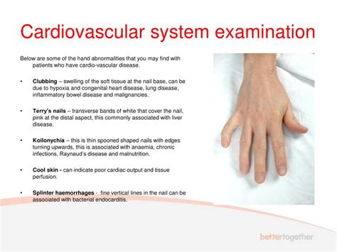Ppt Uwe Bristol Cardiovascular System Examination Powerpoint