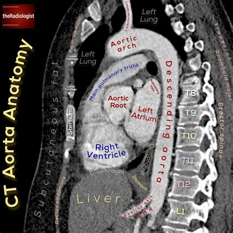 Ct Thorax Anatomy Anatomical Charts Posters SexiezPicz Web Porn