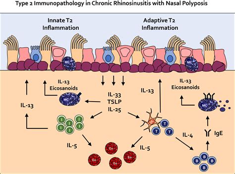 Epithelial Cell Function And Remodeling In Nasal Polyposis Annals Of