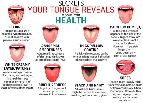 Healthy Tongue Pictures Vs Unhealthy