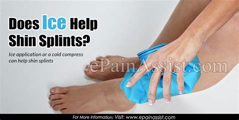 Does Ice Help Shin Splints