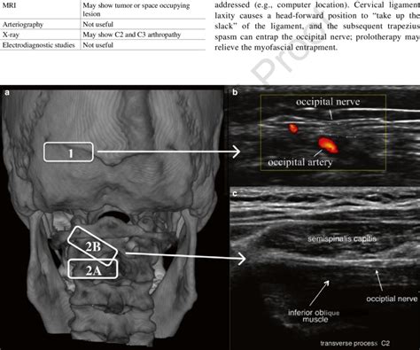 15 Ultrasound Identification Of The Greater Occipital Nerve A
