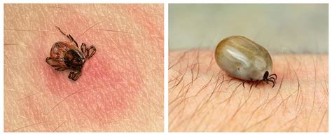 What Do Ticks Look Like Tick Identification Guide