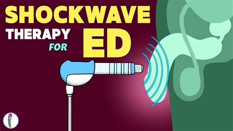 Shockwave Therapy For Erectile Dysfunction Erectile Dysfunction Treatment ED ED Treatment