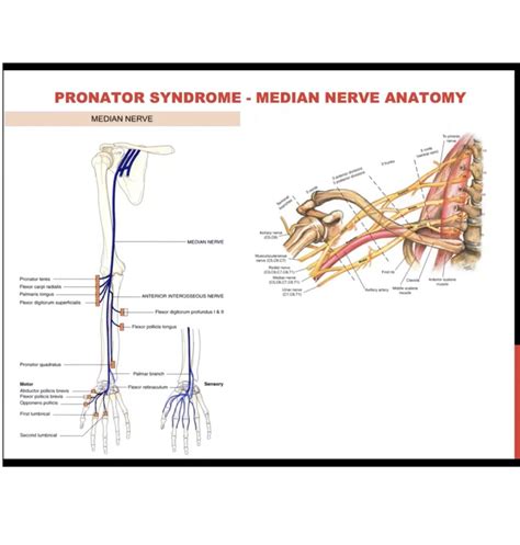 Upper Limb Neuropathies Pronator Syndrome Radial Tunnel Syndrome
