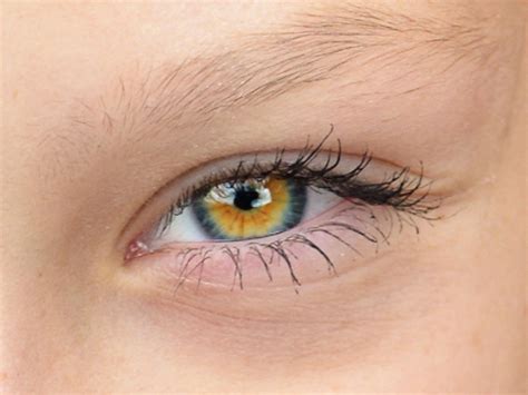 Gorgeous Central Heterochromia Eyes Heterochromia Eyes Pretty Eyes Color Pretty Eyes