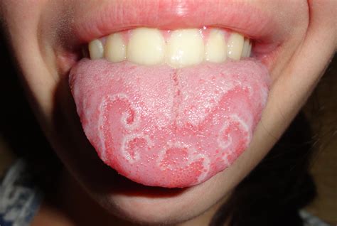 Filegeographic Tongue Cropped Wikipedia