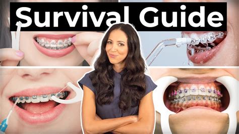How To Prepare And What To Expect With Braces Youtube