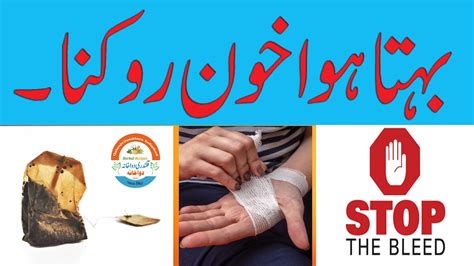 BLEEDING WOUND: Easy Desi way to stop the bleeding with immediate
