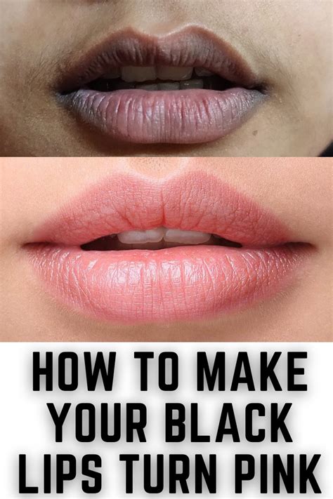 How To Turn Black Lips Into Pink Naturally In 2023 Lip Lightening Black Lips Natural Pink Lips