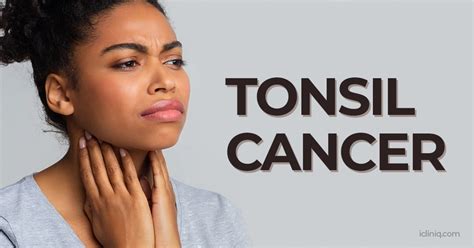 Tonsil Cancer Causes Symptoms Diagnosis Treatment