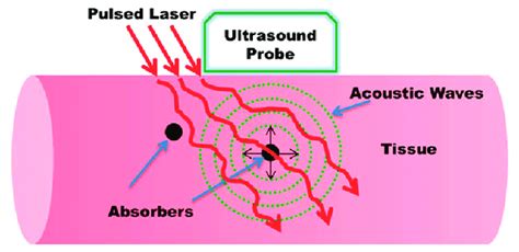 Basic Principle Of Biomedical Photoacoustic Imaging Reproduced With