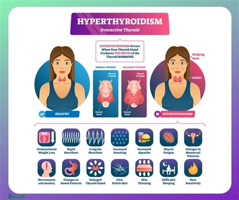 Overactive Thyroid Hyperthyroidism Symptoms Causes Risk Groups