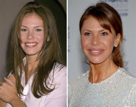 Pin On Celeblens Celebrity Plastic Surgery Before And After Photos