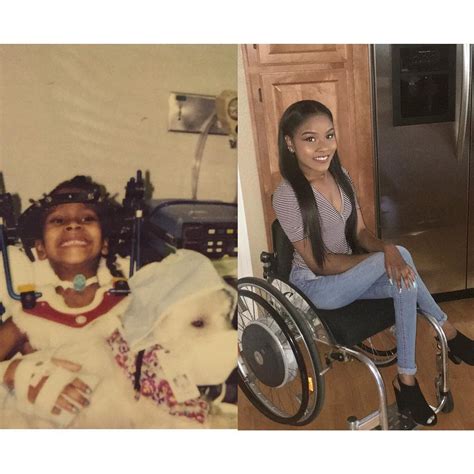 paralyzed woman embraces her disability on instagram