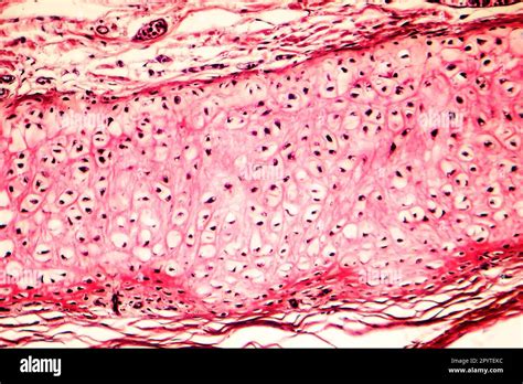 Elastic Cartilage Of Human Outer Ear Light Micrograph Stock Photo Alamy