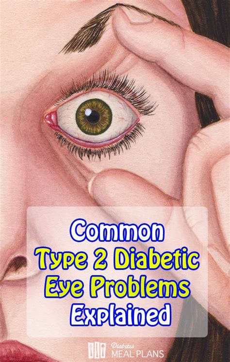 Common Diabetic Eye Problems Explained