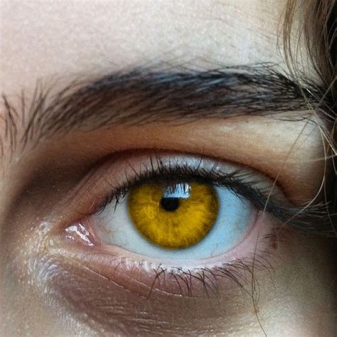 Arriba 102 Foto Por Que Tiene Los Ojos Amarillos Alta Definición