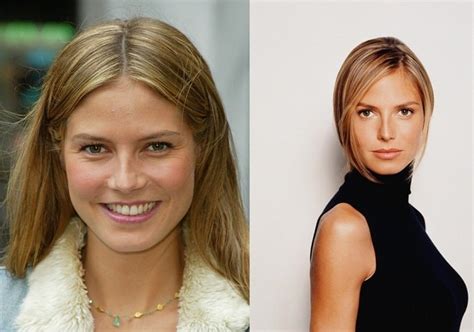 Heidi Klum Before And After Plastic Surgery Boobs Nose Face