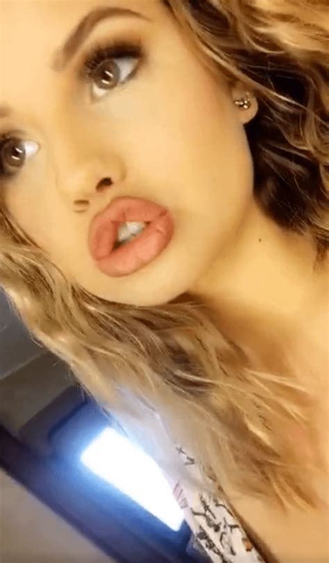 Debby Ryans Overfilled Lips Rbotchedsurgeries