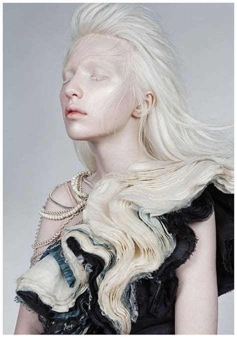 알비노 모델 Nastya Kumarova 사진 백색증이란 Albino Model Albinism Portrait