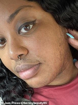 Bearded Woman Reveals How She Learned To Embrace Her Facial Hair