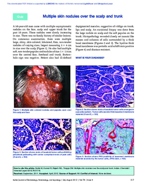 Pdf Multiple Skin Nodules Over The Scalp And Trunk Devinder Thappa