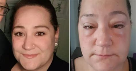We did not find results for: Mom shares warning after waking up and finding her eyes ...