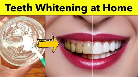 In 2 Minutes How To Whiten Teeth At Home Teeth Whitening At Home