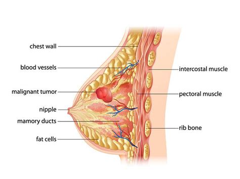 Unlike breast cancer in females, however, breast cancer in men is rare. Breast Cancer: Causes, Symptoms, Types, Signs, Stages and ...